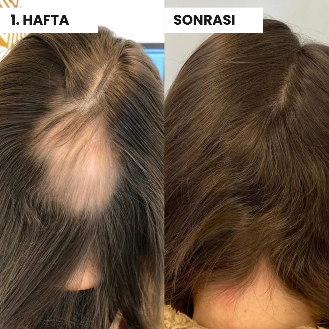 Coconat™ Saç Güzellik Serumu