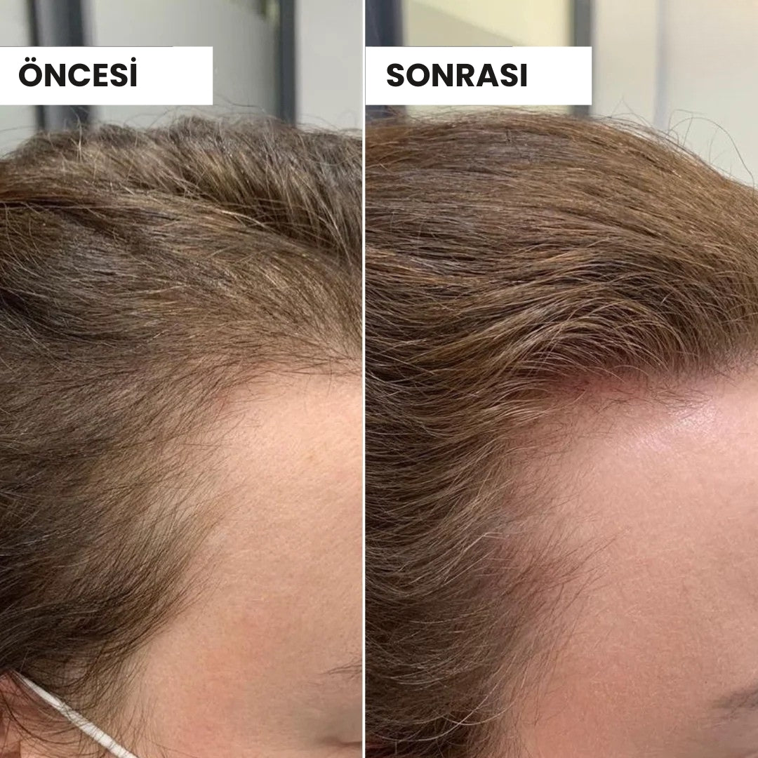 Coconat™ Saç Güzellik Serumu