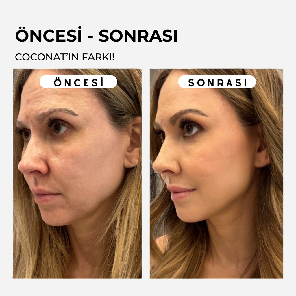 Coconat Botoks Etkili Serum