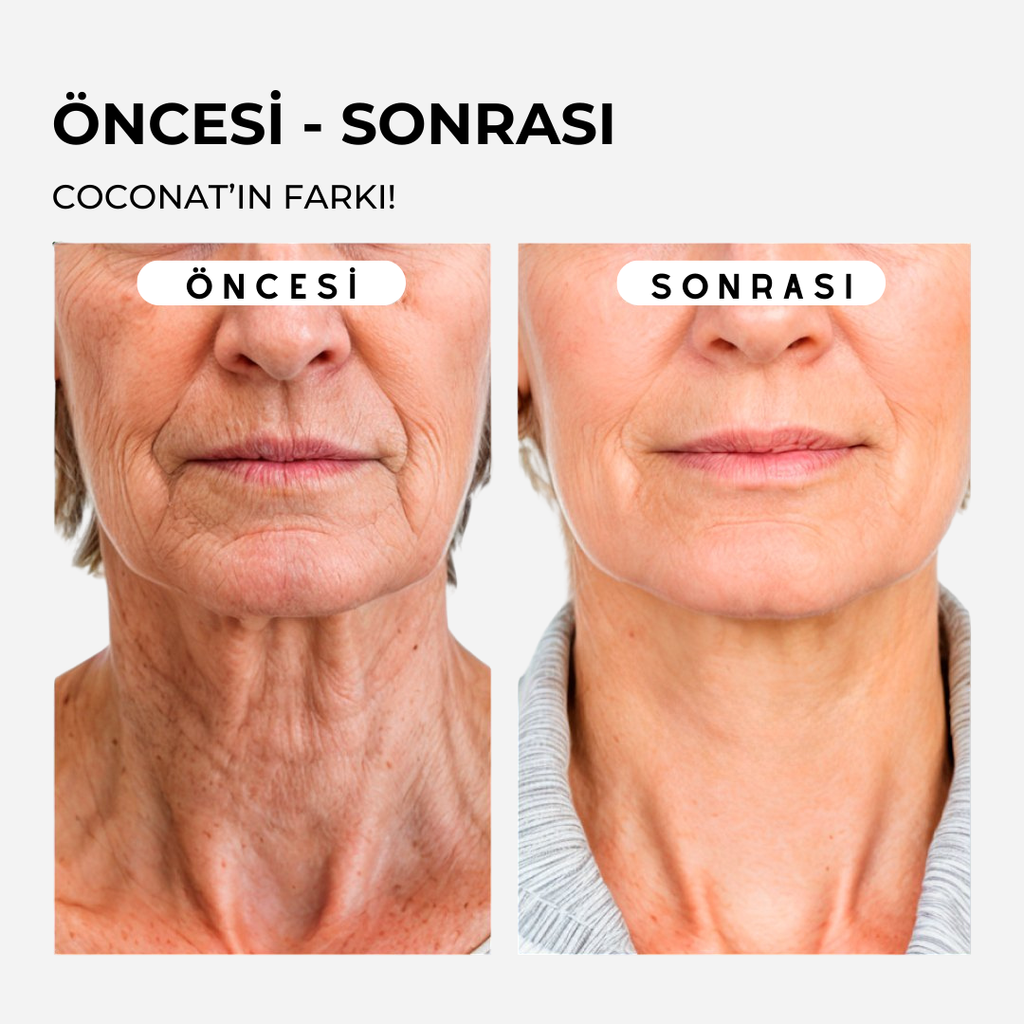 Coconat Botoks Etkili Serum