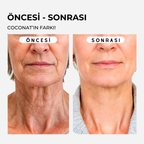 Coconat Botoks Etkili Serum