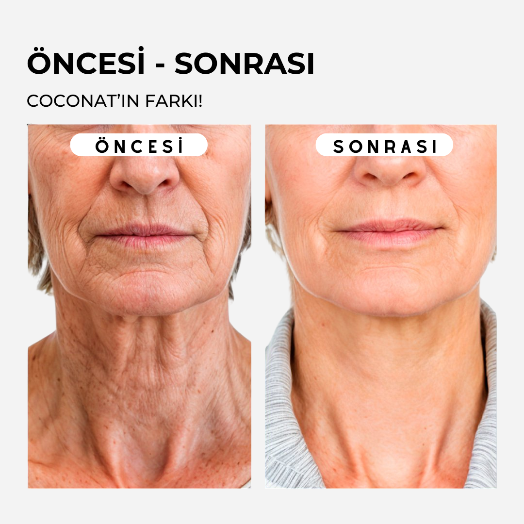 Coconat Botoks Etkili Serum